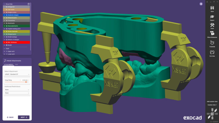 3D-druckbare Artikulatoren