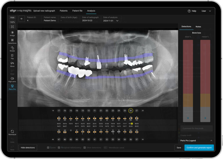 Align X-ray Insights analysiert 2D-Röntgenaufnahmen